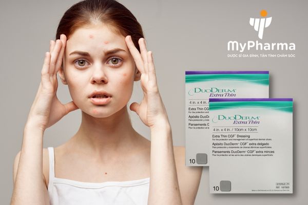 DuoDerm Extra Thin Miếng dán chuyên biệt cho mụn, bỏng và các vết trầy xước
